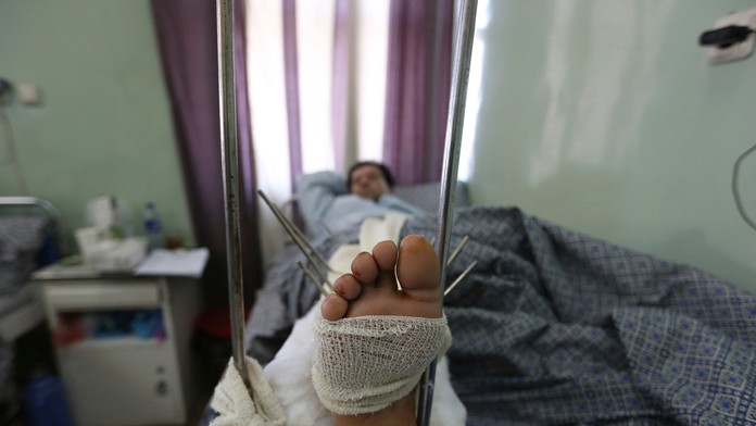 Najväčšia vojenská nemocnica v Kábule po útoku IS. 