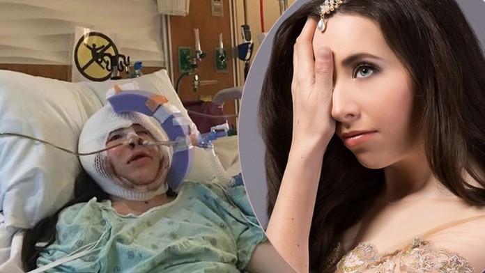 O Ivanke s polovicou tváre, ktorú podporovalo celé Slovensko, vie už celý svet