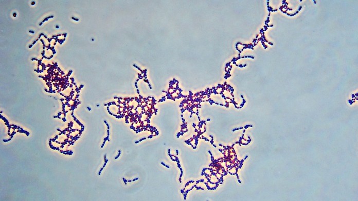 Baktéria Streptococcus pyogenes
