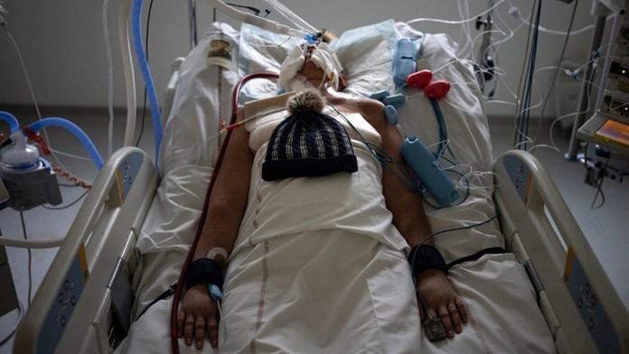 Pacientka s ochorením COVID-19 leží na pľúcnej ventilácii s čiapkou svojho syna na bruchu.