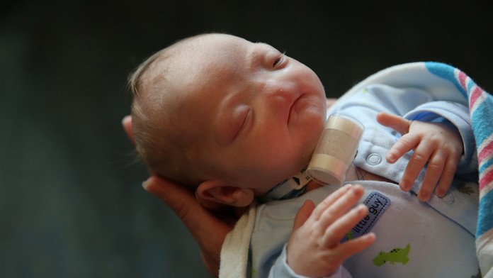 Eli okrem toho, že nemá nos, nemá ani čuch a ani nosovú dutinu.