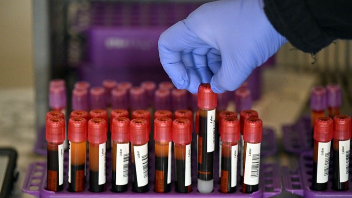 Experiment odhalil, prečo sa niektorí ľudia infikujú koronavírusom a iní nie