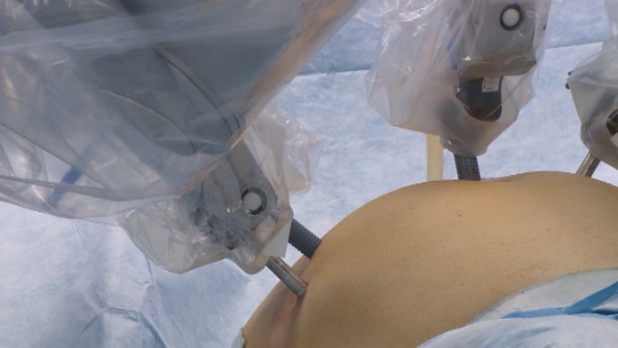 KOTLEBA_tvnoviny.mp4