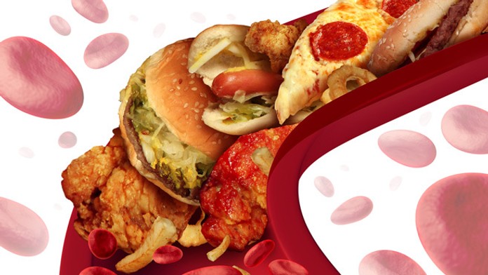 Cholesterol - ilustračná snímka