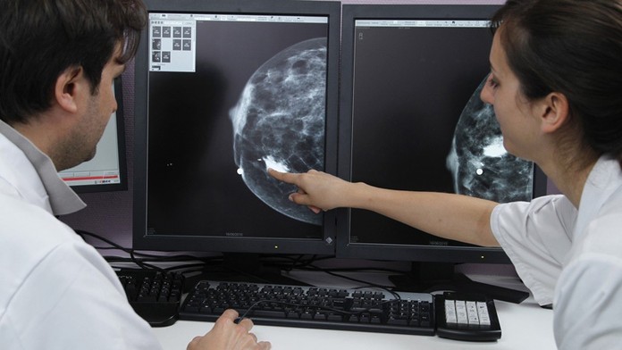 Rakovina prsníka zabíja ženy