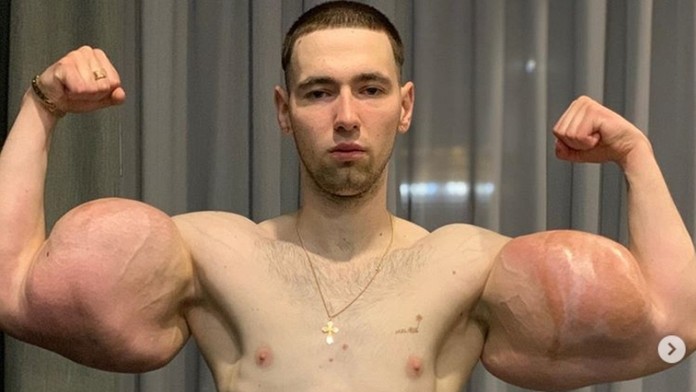 Zhorená časť domu.