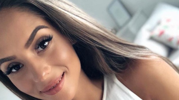 Českej youtuberke popálili na dovolenke tvár. Z komentárov ľudí je na vracanie