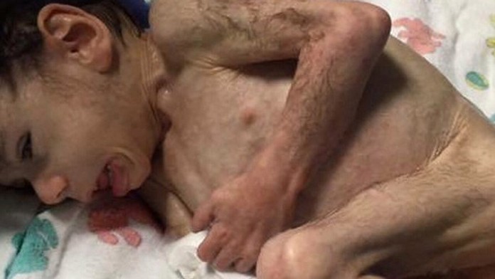 Malý Ryan bol naozaj na pokraji smrti. 