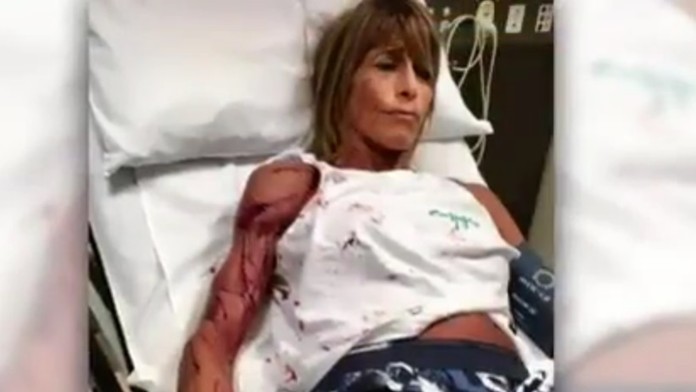 Austrálsku bežkyňu Debbie Urquhartovú napadla kengura.