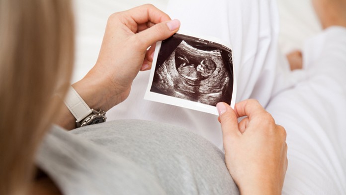 Ultrazvuk - ilustračná snímka - 1