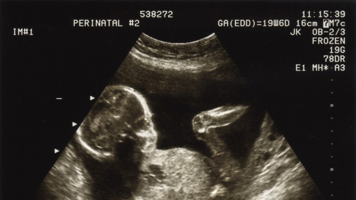 Súd v Salvadore poslal mladú ženu na 30 rokov do väzenia za spontánny potrat