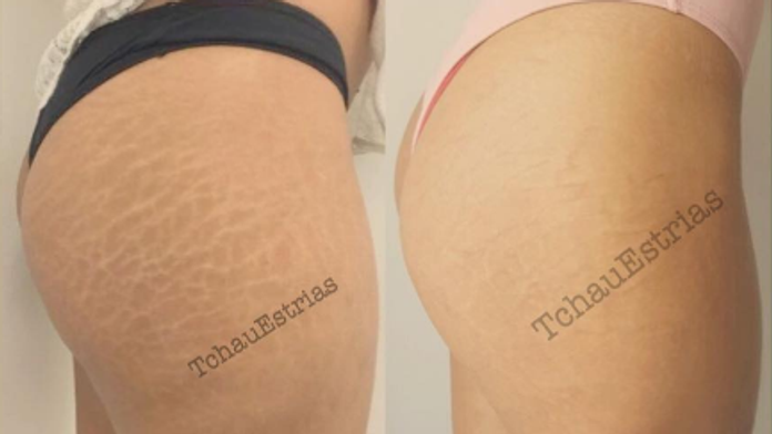 Výsledok je takmer dokonalý.