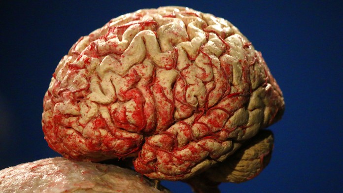 Model ľudského mozgu