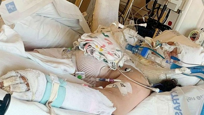 Destini Craneová skúšala nebezpečnú výzvu na internete