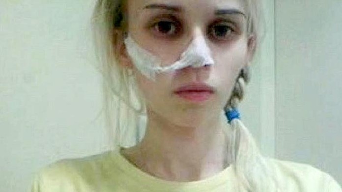 Sophie Hartwellová trpí mentálnou anorexiou.