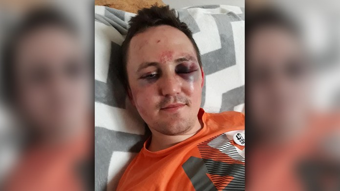 Daniel Radcliffe v Graham Norton Show