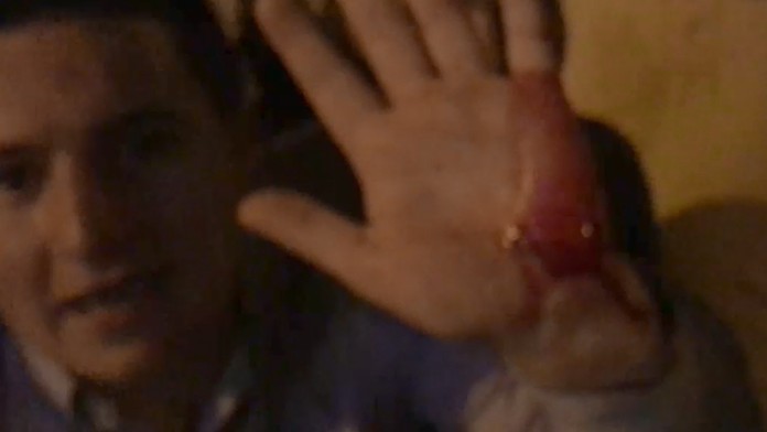 Na snímke jeden zo zranených Angličanov