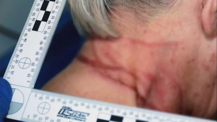 Aby prežila, vyskočila z balkóna.