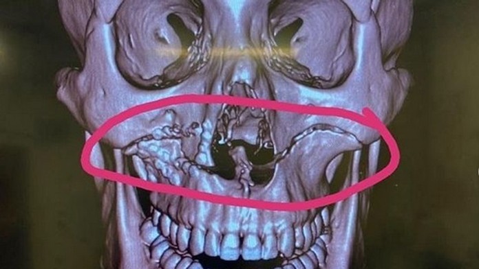 Victoria a David sú spolu už 23 rokov