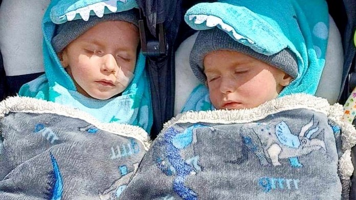 Dvojčatá zabila extrémne vzácna genetická porucha. Na celom svete ňou trpí iba 13 ľudí