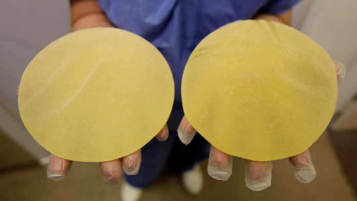 Zdravotná sestra drží chybné prsné implantáty vyrobené francúzskou spoločnosťou Poly Implant Prothese.