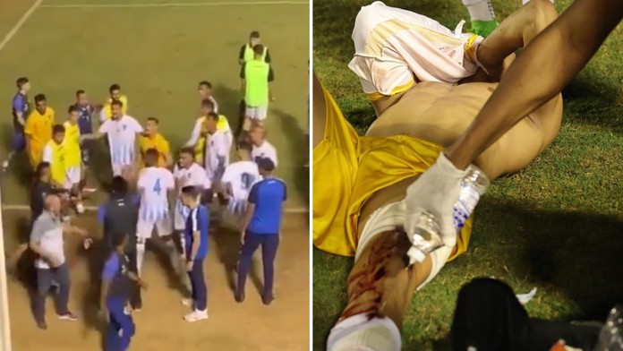 VIDEO: Konanie, aké sa ťažko stretne s pochopením. Policajt mal upokojiť situáciu, no postrelil brankára