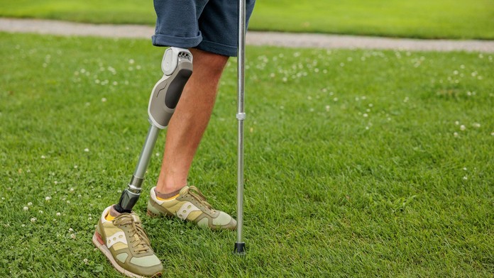 Zdravému mu to dvakrát nevyšlo. Mladík si amputoval nohu, aby obišiel systém