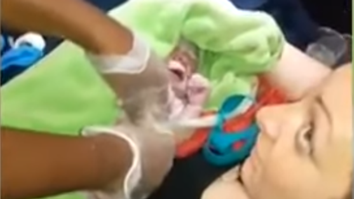 Netradičný pôrod.