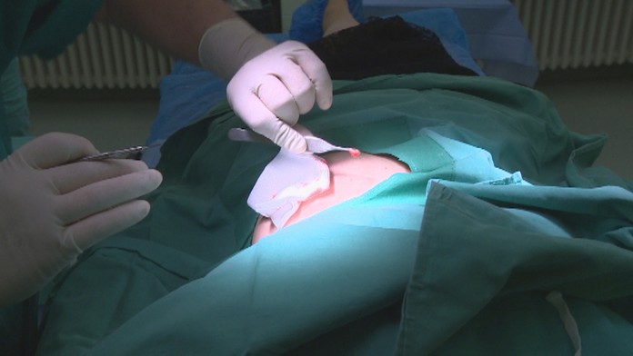 U plastického chirurga.