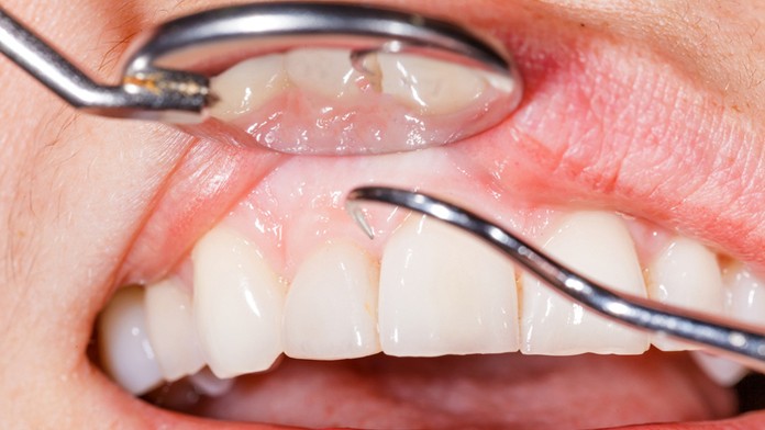 Ilustračná snímka.