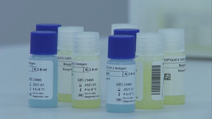 Luky má trému ako ešte nikdy.