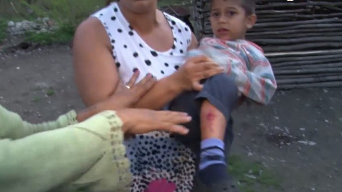 Premožené psy v osade si vybrali svoju daň. Dohrýzli štvorročného chlapca