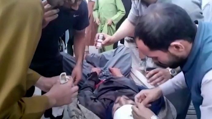 Zranený muž neďaleko miesta výbuchu pri letisku v Kábule.