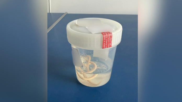 Tlak na hrudi či dýchavičnosť nemusia znamenať len problémy so srdcom. Klinika upozorňuje na kuriózny prípad