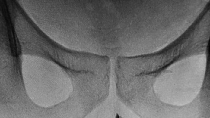 Neželaná nevesta - NOVÉ ČASTI: 63. epizóda