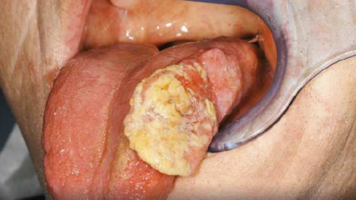 Jeden z obrázkov na škatuľke cigariet