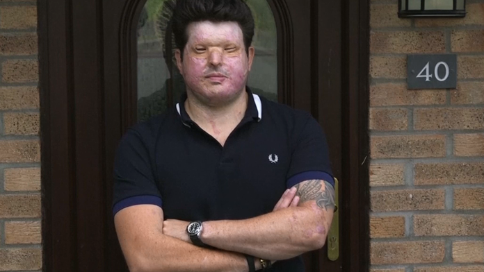 Andreas hovorí o šťastí.