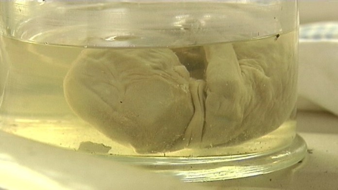 19 PN Pitevna patranie.transferweb_jpg_bez_watermarku_1.jpg