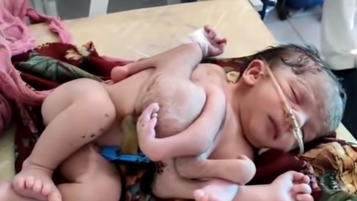 Richard Raši a Michal Truban v relácii Na telo.