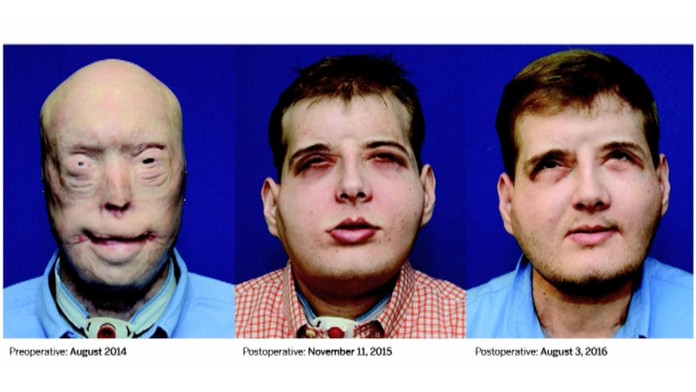 Dva roky v živote Patricka Hardisona.