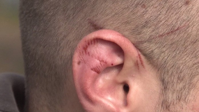 Útočil slovne aj fyzicky.