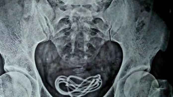 nr_poziar_farmy_pre_web_TFF_tvnoviny.mp4