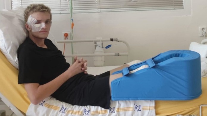 Vysoko infekčné ochorenie ho pripravilo o nohy. Mladík (17) z Česka teraz potrebuje protézy