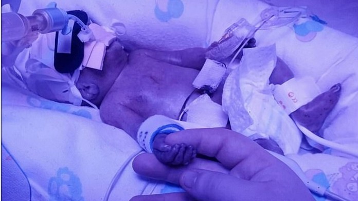 Pri stavbe bytovky sa zranili robotníci.