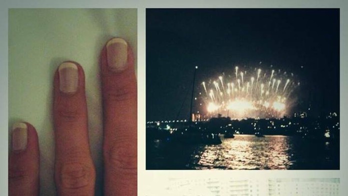 Caroline Wozniacka sa zasnúbila.