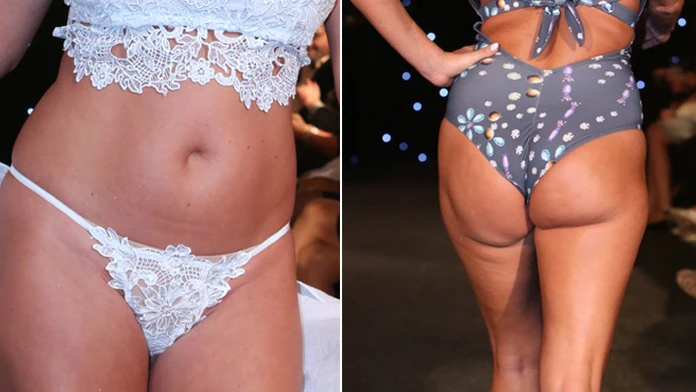 Kedysi sexy, dnes akási povädnutá. Česká modelka šokovala postavou