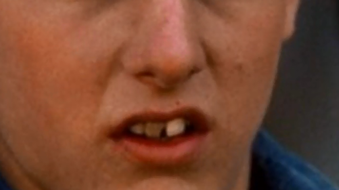 Zuby hollywoodskych hviezd predtým