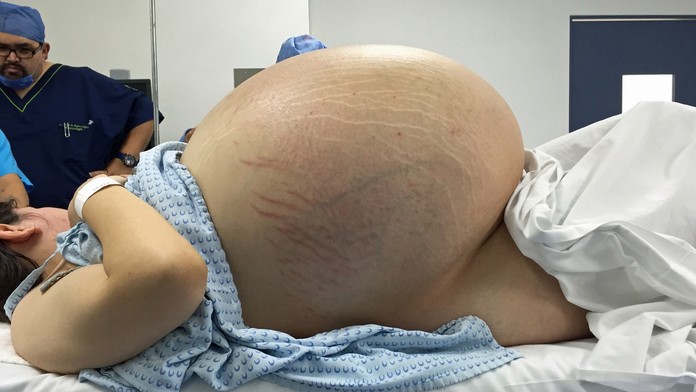 Pacientka sa uzdravila. 