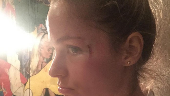 Gáboríka prišla na zápas podporiť priateľka. Schytala pukom do tváre