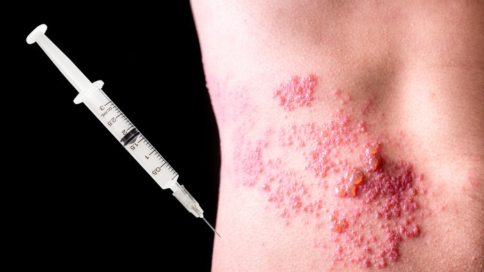 Ilustračná snímka